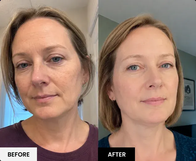 Before and after comparison 2 published by Glokore; results vary